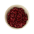 Kidneybonen